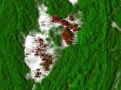 Stres kaynaklı kalp krizlerinde bakteri etkisi