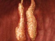 Hayvanın içinde organ yetiştirdik