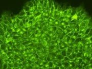 iPSC yöntemiyle endotel hücreler oluşturuldu