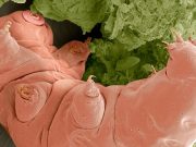 Tardigradların tüm hayvanlara en yabancı DNA’ya sahip oldukları anlaşıldı