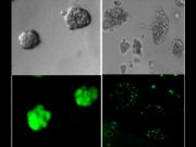 Kansere çözüm, bakteriyel iletişimde mi?