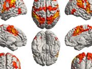 Müzik, beynin Alzheimer hastalığından korunmuş bölgelerini harekete geçiriyor!