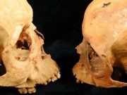 Moleküler düzeyde erkekler ve kadınlar: Y dediğin sapı kopmuş bir X