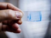 Candida auris: Bu ismi aklınızda tutun, kendisi sessiz sedasız tüm dünyaya yayılıyor