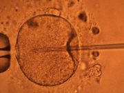 Sanayileşmenin bedelini sperm sayısındaki azalmayla mı ödüyoruz?
