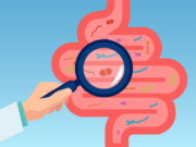 Bağırsak bakterilerinin kilo almayla ilişkisi var mı?