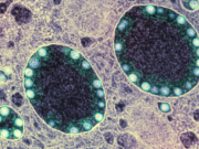 Kovid-19’a karşı koruma sağlayan bir burun spreyi geliştirildi