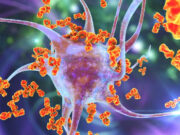 Multipl skleroz genleri hayvanlardan bulaşan hastalıkları engellemek için mi ortaya çıktı?